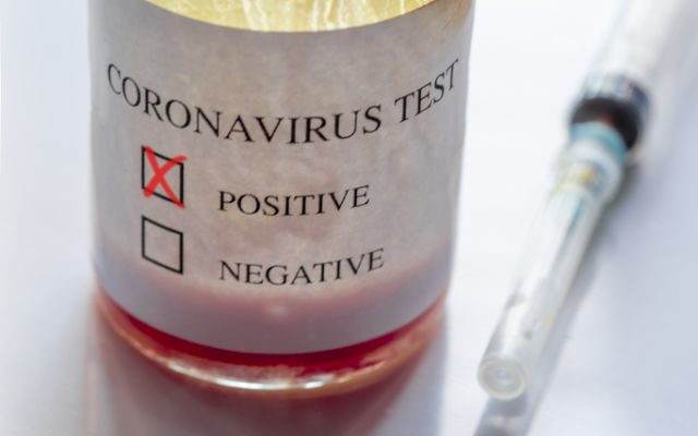 Coronavirus Testing Begins Locally With A Doctor’s Order